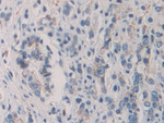 KIR2DL2 Antibody in Immunohistochemistry (Paraffin) (IHC (P))