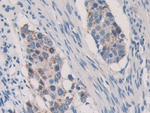 KIR2DL2 Antibody in Immunohistochemistry (Paraffin) (IHC (P))