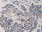 KIR2DL2 Antibody in Immunohistochemistry (Paraffin) (IHC (P))