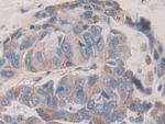 KIR2DL2 Antibody in Immunohistochemistry (Paraffin) (IHC (P))