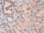 KIR2DL3 Antibody in Immunohistochemistry (Paraffin) (IHC (P))