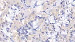 Bcl-W Antibody in Immunohistochemistry (Paraffin) (IHC (P))