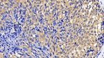 Bcl-W Antibody in Immunohistochemistry (Paraffin) (IHC (P))