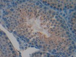 CYR61 Antibody in Immunohistochemistry (Paraffin) (IHC (P))