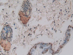 CYR61 Antibody in Immunohistochemistry (Paraffin) (IHC (P))