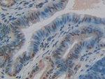 CYR61 Polyclonal Antibody