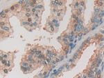 PION Antibody in Immunohistochemistry (Paraffin) (IHC (P))