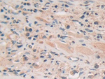 PION Polyclonal Antibody
