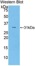 PION Antibody in Western Blot (WB)