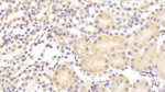 NUP133 Antibody in Immunohistochemistry (Paraffin) (IHC (P))