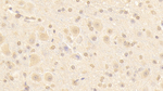 NUP133 Polyclonal Antibody