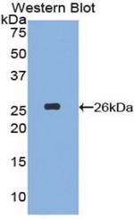 NUP133 Antibody in Western Blot (WB)