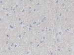 Cullin 9 Polyclonal Antibody
