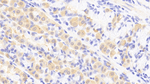 RARRES1 Polyclonal Antibody