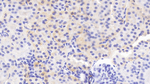 RARRES1 Antibody in Immunohistochemistry (Paraffin) (IHC (P))