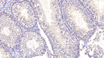 NEIL3 Antibody in Immunohistochemistry (Paraffin) (IHC (P))