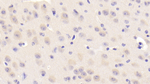 NEIL3 Polyclonal Antibody