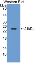 NEIL3 Antibody in Western Blot (WB)