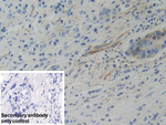 WARS Polyclonal Antibody
