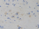 WARS Antibody in Immunohistochemistry (Paraffin) (IHC (P))