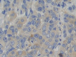 WARS Antibody in Immunohistochemistry (Paraffin) (IHC (P))