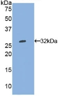 WARS Antibody in Western Blot (WB)
