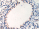 WARS Antibody in Immunohistochemistry (Paraffin) (IHC (P))