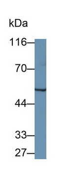 WARS Antibody in Western Blot (WB)