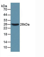 WARS Antibody in Western Blot (WB)