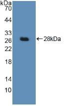 DDB2 Antibody in Western Blot (WB)