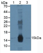 DDB2 Polyclonal Antibody