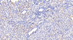 SERPINB3 Polyclonal Antibody
