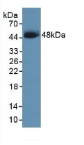 SERPINB3 Antibody in Western Blot (WB)