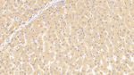 THRB Polyclonal Antibody