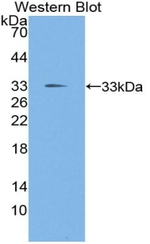 KLF10 Polyclonal Antibody