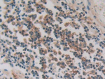 PKIG Antibody in Immunohistochemistry (Paraffin) (IHC (P))