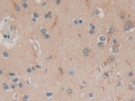 PKIG Antibody in Immunohistochemistry (Paraffin) (IHC (P))