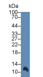 S100A7 Antibody in Western Blot (WB)