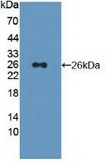 PSMD5 Antibody in Western Blot (WB)