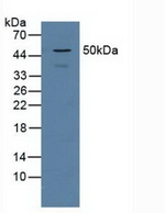 PSMD5 Antibody in Western Blot (WB)