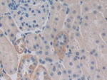 Centaurin alpha-2 Antibody in Immunohistochemistry (Paraffin) (IHC (P))