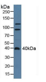 Centaurin alpha-2 Antibody in Western Blot (WB)
