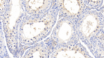 A1BG Antibody in Immunohistochemistry (Paraffin) (IHC (P))