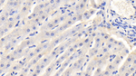 A1BG Antibody in Immunohistochemistry (Paraffin) (IHC (P))