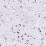 ALX1 Antibody in Immunohistochemistry (Paraffin) (IHC (P))