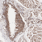 ALX1 Polyclonal Antibody
