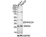 ZDHHC24 Antibody in Western Blot (WB)