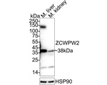 ZCWPW2 Polyclonal Antibody