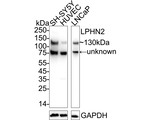 LPHN2 Polyclonal Antibody
