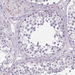 VGLUT1 Antibody in Immunohistochemistry (Paraffin) (IHC (P))